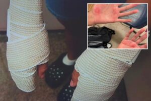 Texas middle school cheerleaders suffer burns to hands after coach’s ‘malicious’ punishment in heat