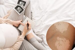 I jokingly suggested a fungal infection as a baby name to my pregnant sister — and she’s using it