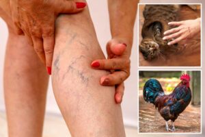 ‘Doctor death’ forensic pathologist reveals the worst ways people can die: ‘Never trust a rooster’