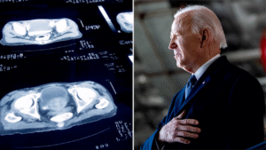 Biden’s ‘last known’ prostate cancer screening was over a decade ago, as questions mount over diagnosis