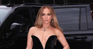 Jennifer Lopez Shares Photos of Severe Facial Injury From AMAs Rehearsals