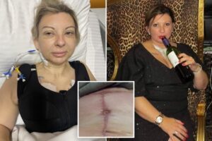 I spent over K on a ‘mommy makeover’ in Turkey — it’s my life’s ‘biggest regret’