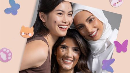 Why Gen Z can’t get enough of Dododots’ colourful pimple patches