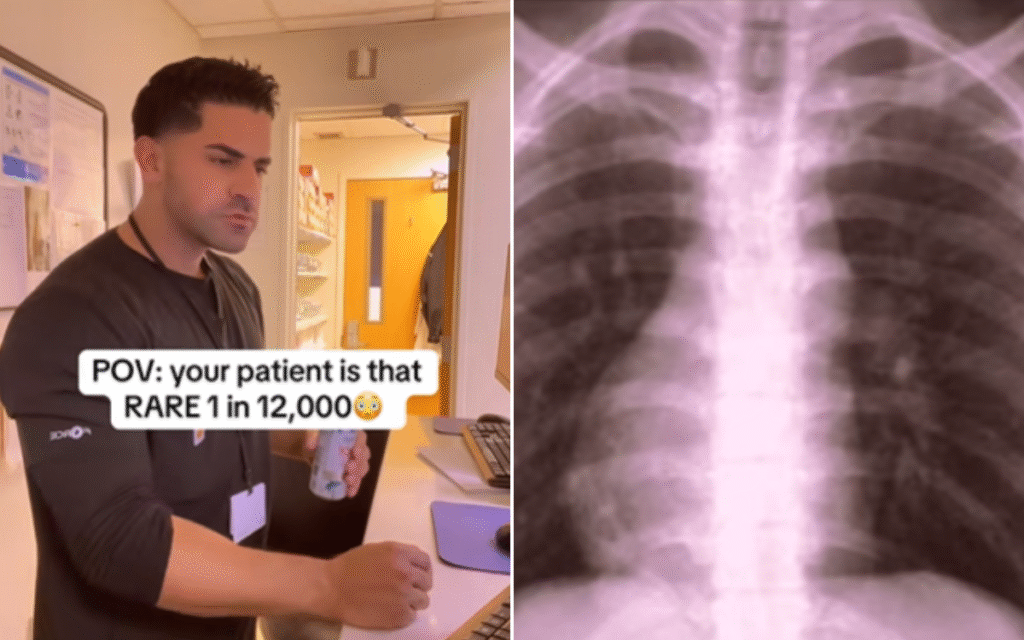 Patient Goes In for Routine X-Ray—Then Radiologist Sees Something ‘So Rare’