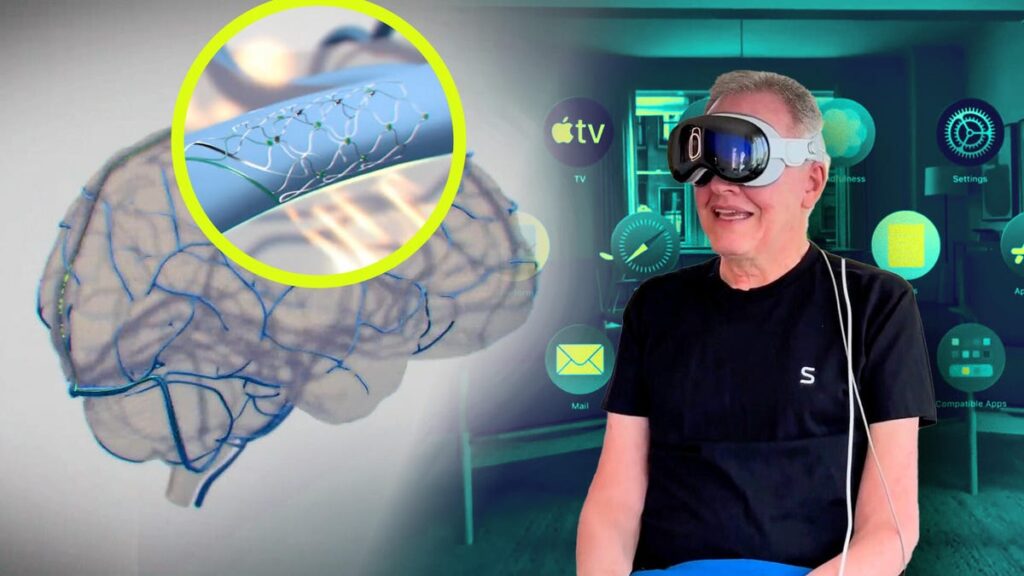 Coming Soon to Apple Devices: Brain Control Accessibility Features