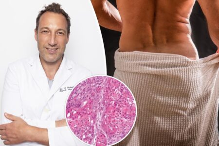 I’m ‘Dr. Butthole’ — beware this warning sign that could lead to a scary ‘silent disease’