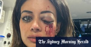 Former Greens candidate, bruised and bloodied, undergoes facial surgery after police arrest