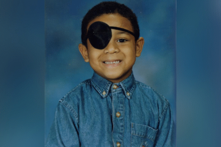 Boy Wears Eyepatch in First School Photo—Had No Idea the Danger He’d Beaten