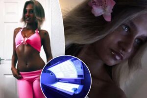 I’m a sunbed addict and I’ve got scary moles all over — but I can’t stop tanning