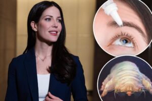 This creepy cause of dry eye is often overlooked and totally ‘distressing’ — how to fix it
