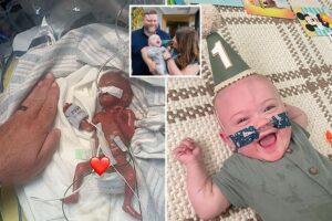 World’s most premature baby defies all medical odds to reach 1st birthday