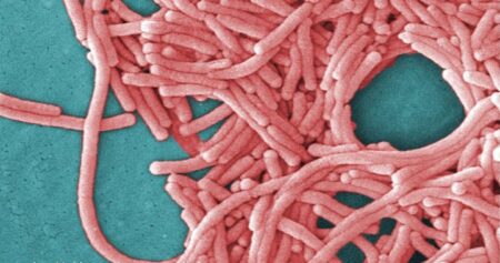 1 dead, dozens sick in legionnaires’ disease outbreak in London, Ont.