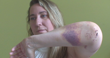 Second victim of alleged Kelowna hammer attack mourns the loss of friend