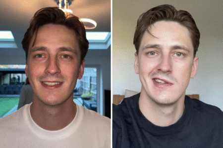 Man Goes to Sleep, Wakes Up With a ‘Half Paralyzed Face’