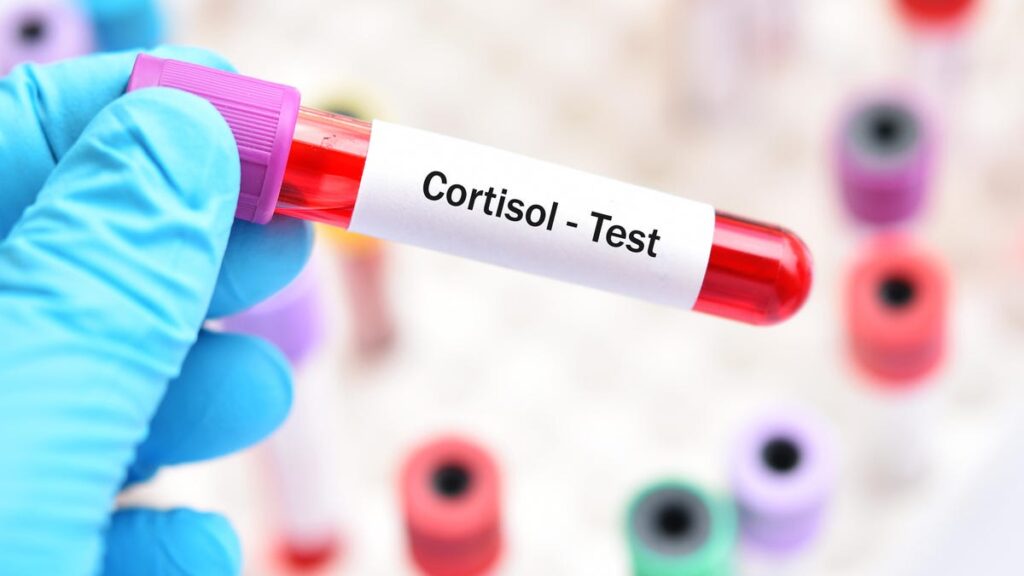 I Got a Cortisol Blood Test. What I Learned About My Stress Was Important, but Not Fun