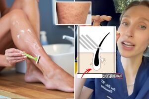 Dermatologist reveals her counterintuitive tip to prevent ingrown hairs after shaving