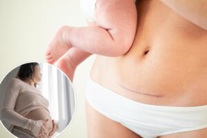 Planned C-sections can increase your child’s risk of these serious conditions