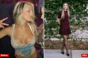 Why Gen Z, Millennial women are rejecting once-trendy breast implants and face fillers: ‘Just not into overdoing it anymore’