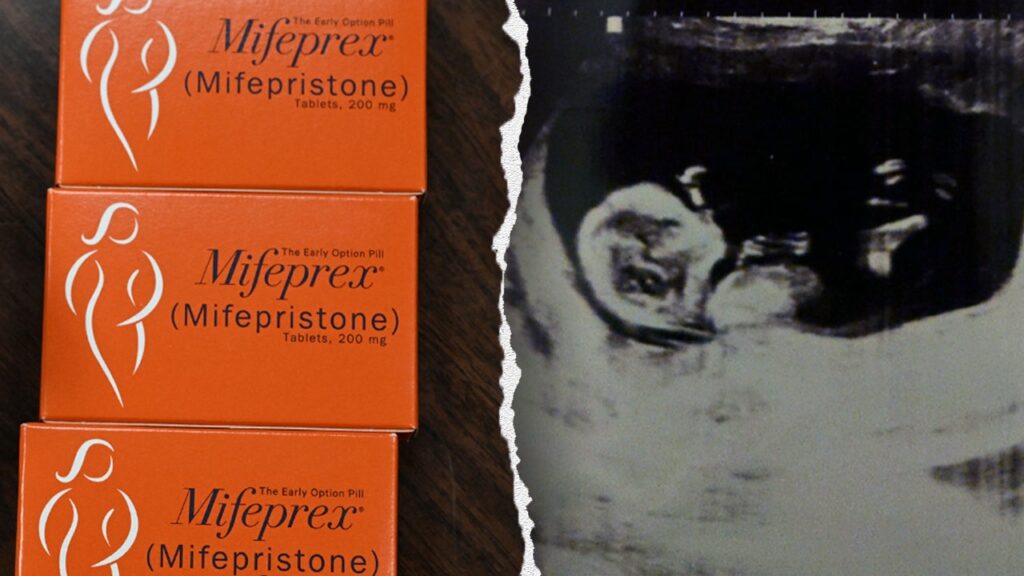 Texas man sues California doctor in unprecedented abortion pill case over unborn child’s alleged ‘murder’