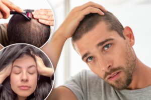 5 ways to reduce hair loss without drugs or supplements — and a bad hack that will make your scalp worse
