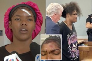 Exclusive | LI teen allegedly attacked by rival’s mom with metal ‘Stanley’ mug is too traumatized to return to school: ‘Thought I was going to die’