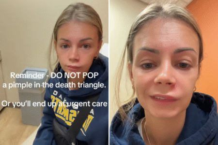 Horror as Woman Winds Up in Urgent Care After Trying To Pop Pimple