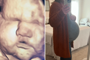 3D Scan Predicted Big Baby—Then She Arrived: ‘Thank Goodness for Epidurals’