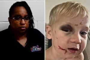 Daycare worker arrested for child abuse as toddler left with black eye and swollen face on first day at church-run center