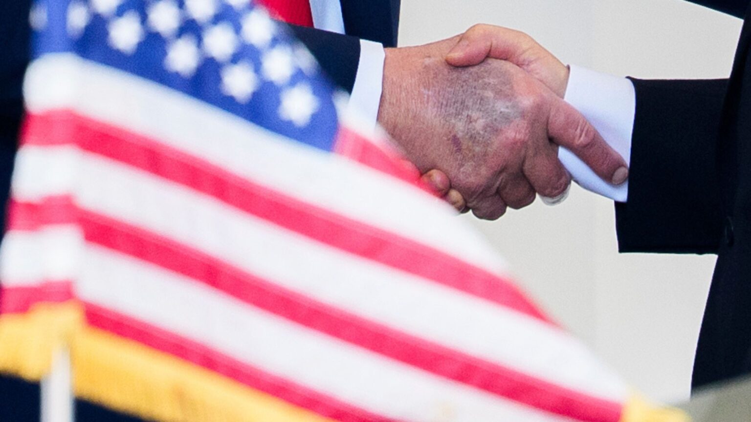 Donald Trump’s Bruised Hands Come Under Scrutiny: ‘People Deserve Answers’