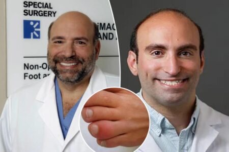 Beware ‘sausage toe’: Foot injury that’s more common in summer can get much worse if left untreated