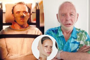 Anthony Hopkins channels Hannibal Lecter with Kim Kardashian’s Skims face wrap: ‘Feeling 10 years younger’