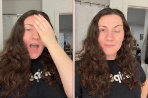 Woman gets Botox to treat migraines—but it goes horribly …