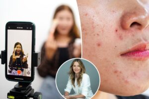 Beware the ‘glow trap’: Dermatologist warns TikTok is driving the rise of painful ‘influencer inflammation’