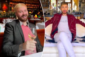 I spent K on my filler addiction — now he warns of the danger