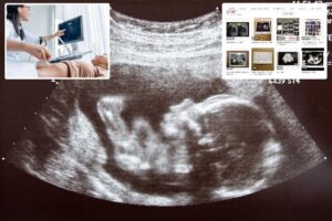 Bizarre ultrasound photo scam targets unsuspecting men at risk of being extorted in pregnancy fraud