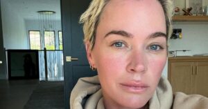 Teddi Mellencamp Shows Hair Growth Progress While Sharing Honest Update Amid Cancer Battle