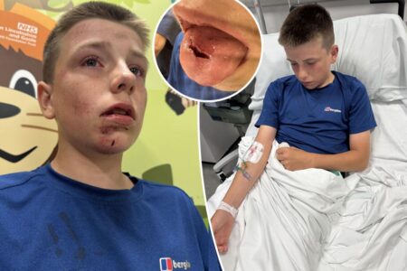 Horsing around teen nearly bites off tongue during dangerous social media ‘tap out’ challenge: ‘His friends were distraught’