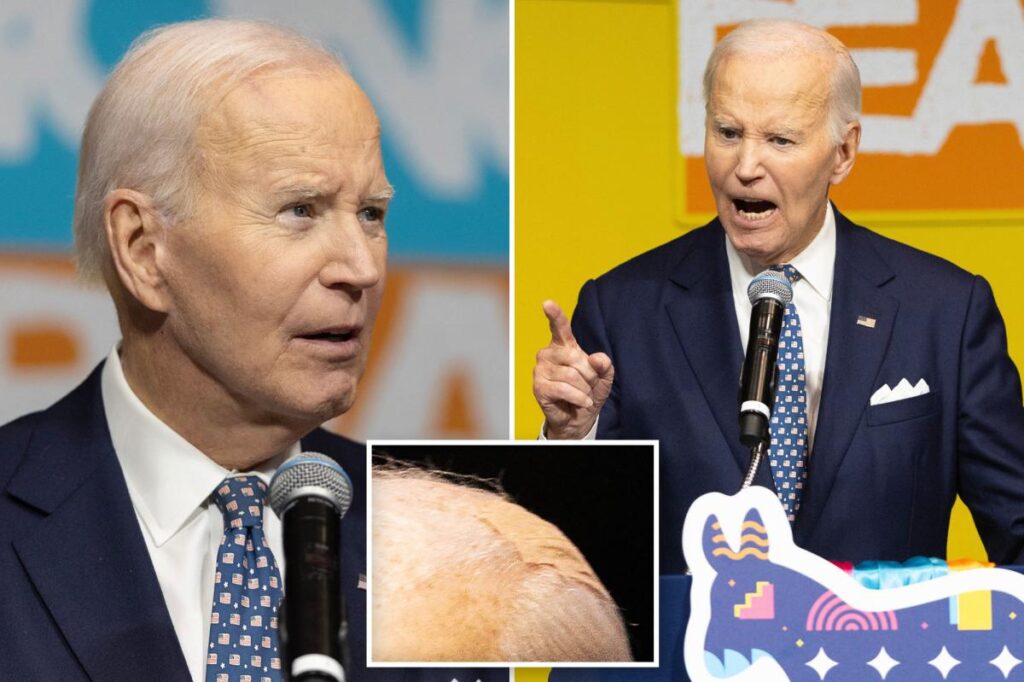 Bandaged-up Biden says son Beau ‘should’ve been the president, not me’ in speech ripping Trump Bandaged-up Biden says son Beau ‘should’ve been the president, not me’ in speech ripping Trump