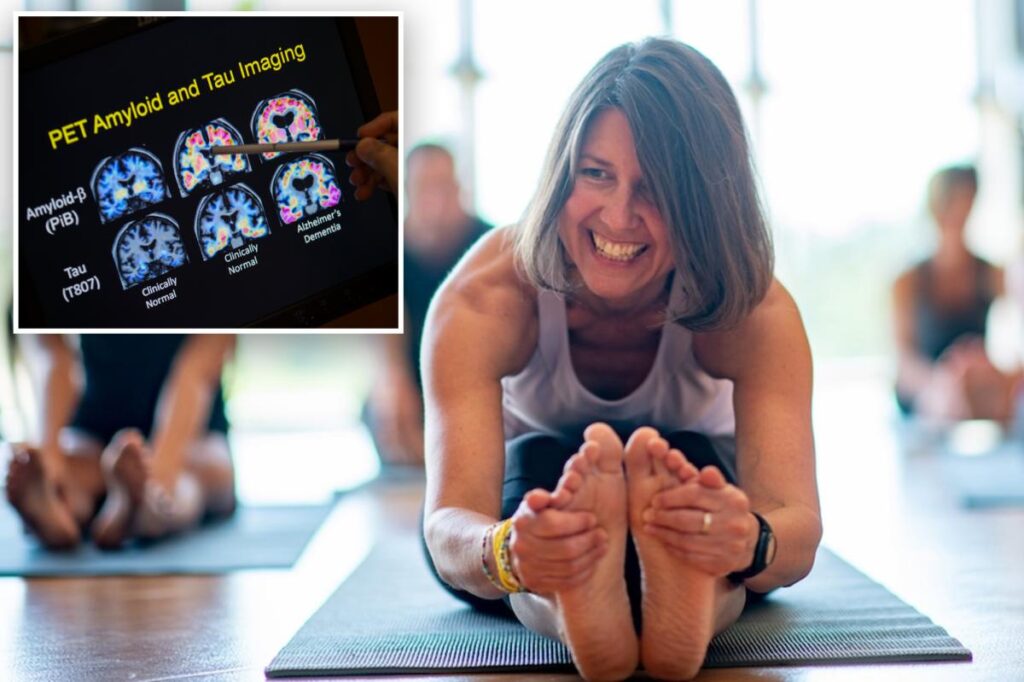 Alzheimer’s risk declines sharply with one daily lifestyle change, researchers say Alzheimer’s risk declines sharply with one daily lifestyle change, researchers say