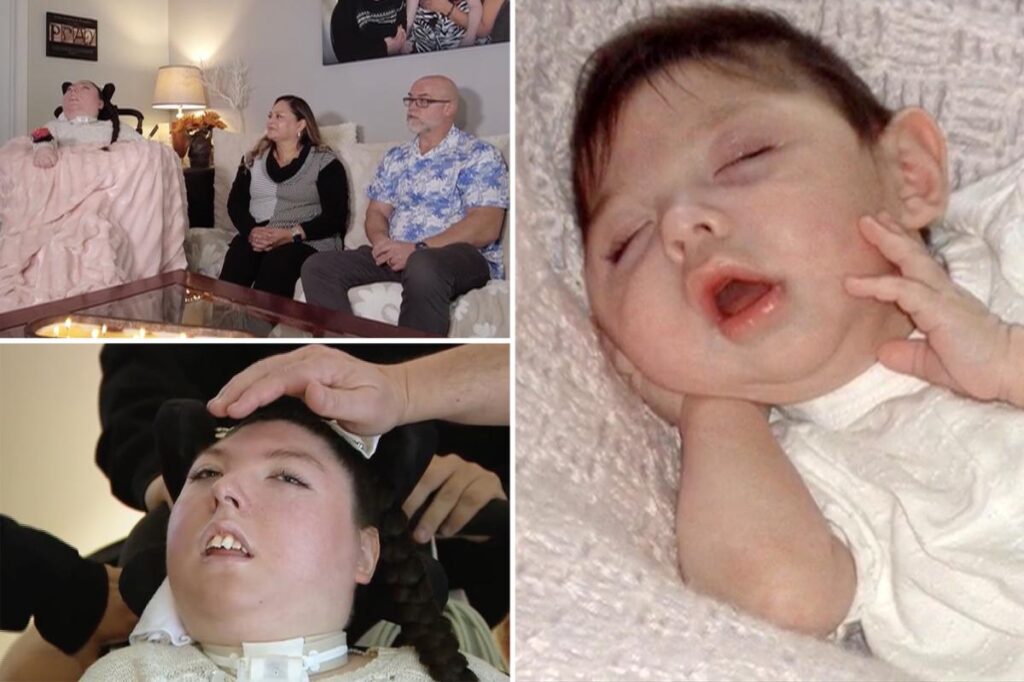 Woman born with no brain turns 20 in medical ‘miracle’ — told she’d never make it to 5 Woman born with no brain turns 20 in medical ‘miracle’ — told she’d never make it to 5