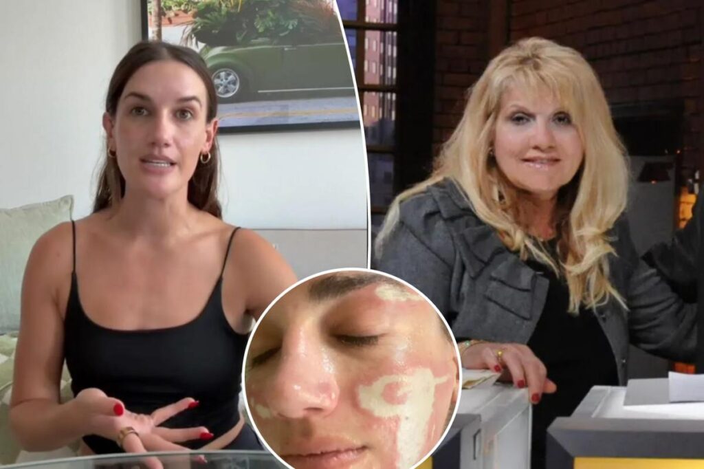 Celebrity esthetician sued for K after client says she was left ‘severely burned and permanently scarred’ Celebrity esthetician sued for K after client says she was left ‘severely burned and permanently scarred’