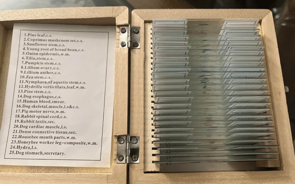 Man Makes Unusual Find at Goodwill, at Home Discovers Human Blood Inside Man Makes Unusual Find at Goodwill, at Home Discovers Human Blood Inside