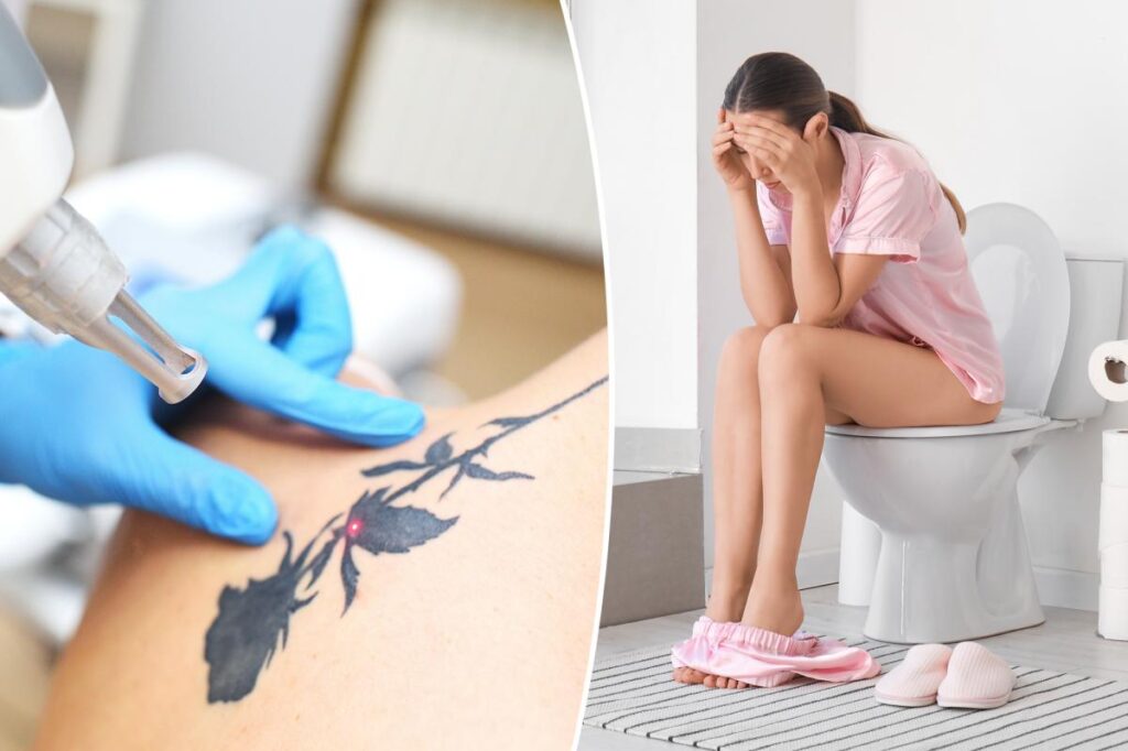 Peeing out your tattoo: What really happens in your body when you have body art removed