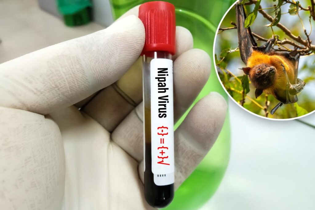 What is Nipah virus? Disease with ‘relatively high death rate’ found in India