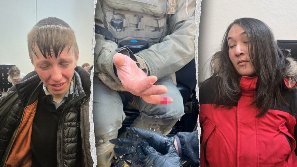 Anti-ICE agitator allegedly bites off federal officer’s finger during Minneapolis attack