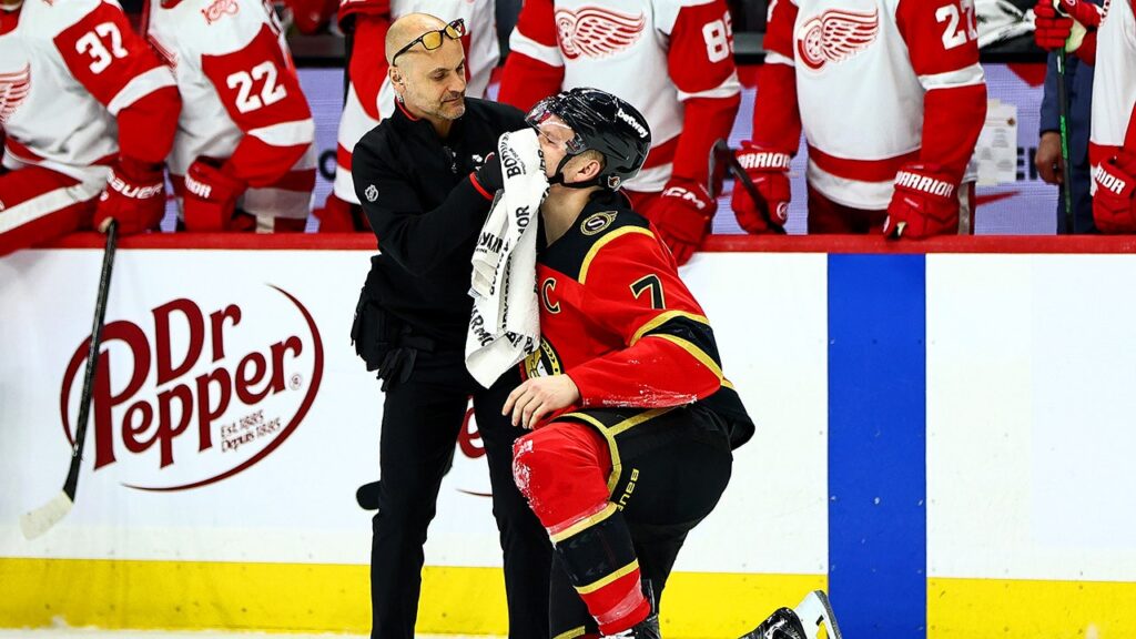 Team USA star Brady Tkachuk bloodied after hit, receives game misconduct in NHL return Team USA star Brady Tkachuk bloodied after hit, receives game misconduct in NHL return