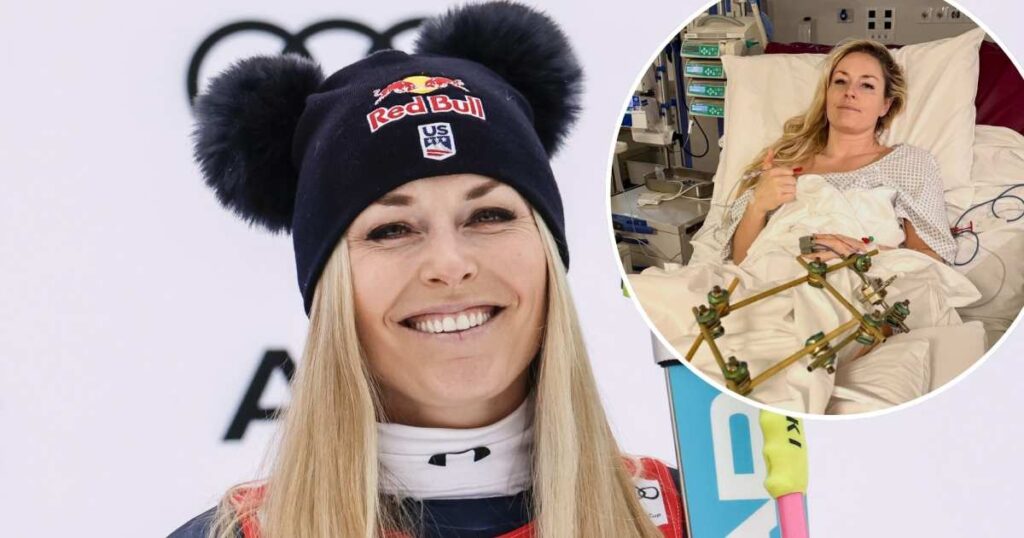 Lindsey Vonn Shares Photo From Hospital After 3rd ‘Successful’ Surgery Following Olympic Crash