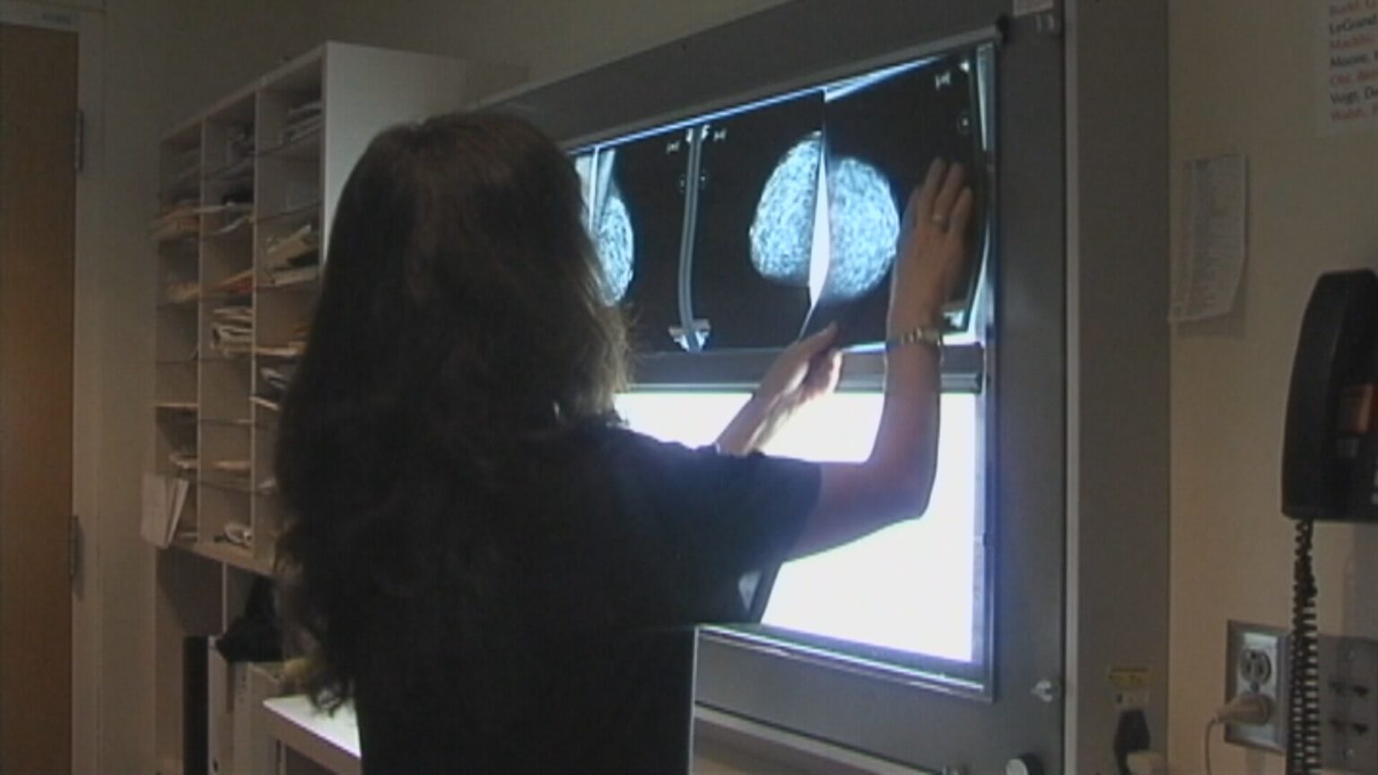 Breast cancer initiative sending patients to Alberta is reducing Sask. wait list