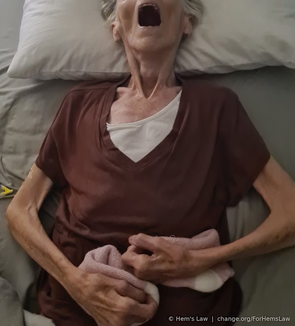 As her Alzheimer’s progressed, Hem lost the ability to swallow, and was eventually unable to move, eat or drink. She spent nearly two weeks in this state before passing.