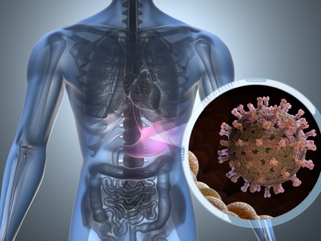 Rotavirus Spreads Across US—What Are Symptoms?